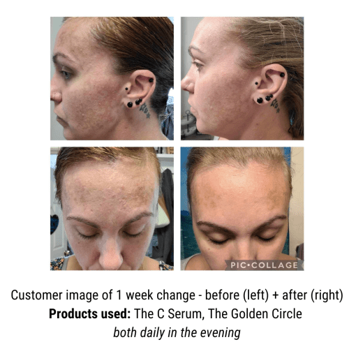 GoldenCircleCSerumBeforeandAfter 70375876 35cc 42e6 b5dc 64e16c4fa953